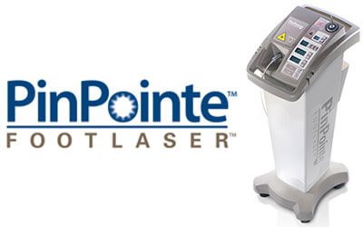 PinPointe Laser Treatment Pinpointe laser treatment for nail fungus